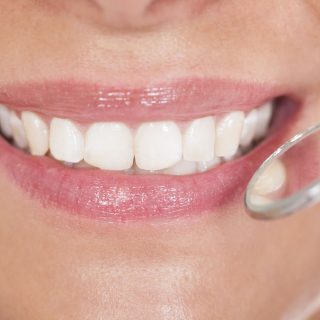 estética dental centro odontológico integral mallorca