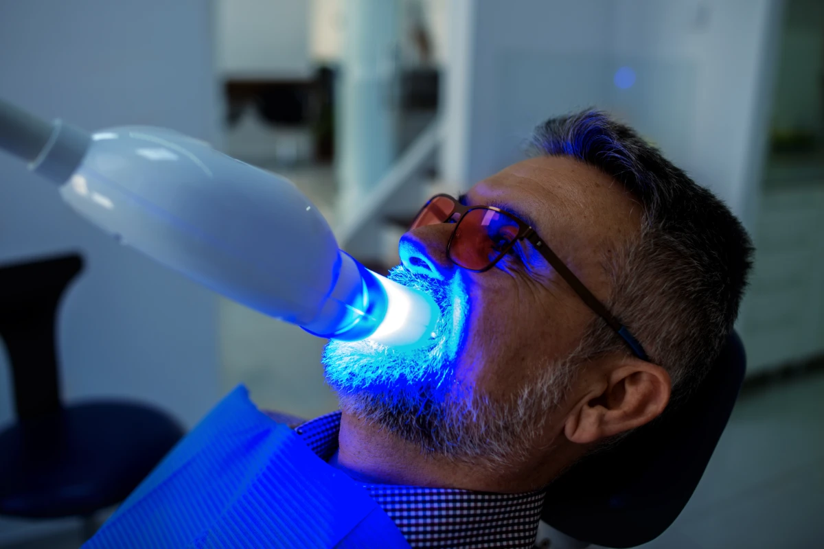 Blanqueamiento Dental Estetica Dental Coi Palma