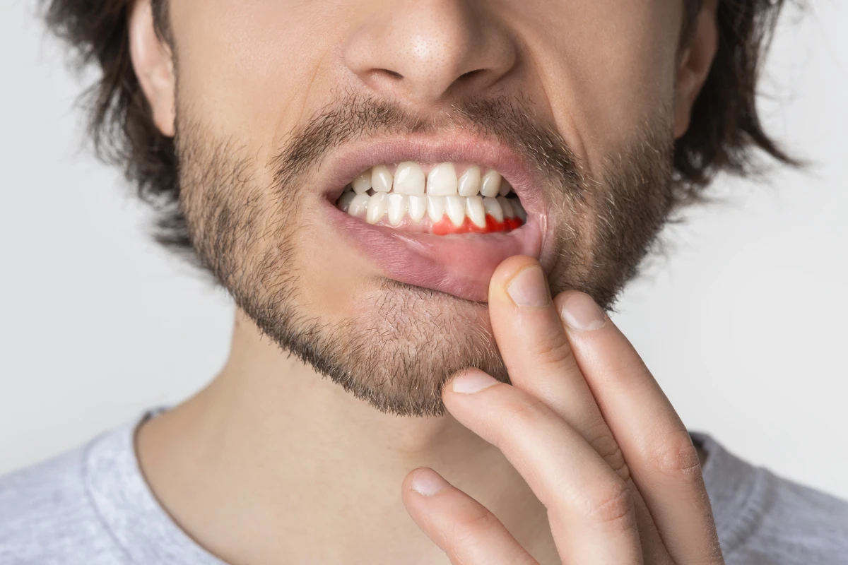 Encias Sanas Periodoncia Coi Palma