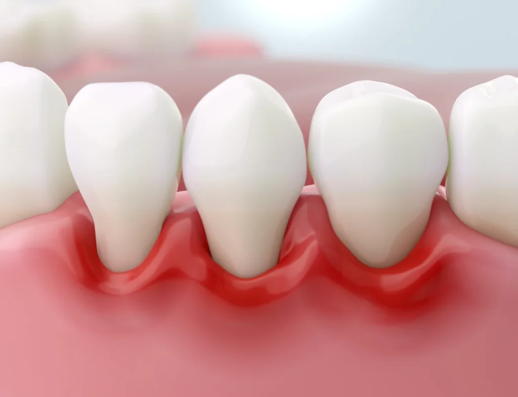 Main Periodoncia Coi Palma