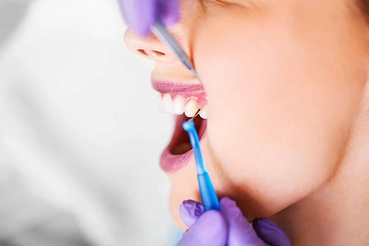 Protege Periodoncia Coi Palma